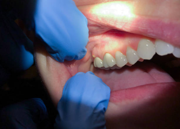 Best Urgent Care for Lost Fillings or Crowns in Pelican Rapids, MN